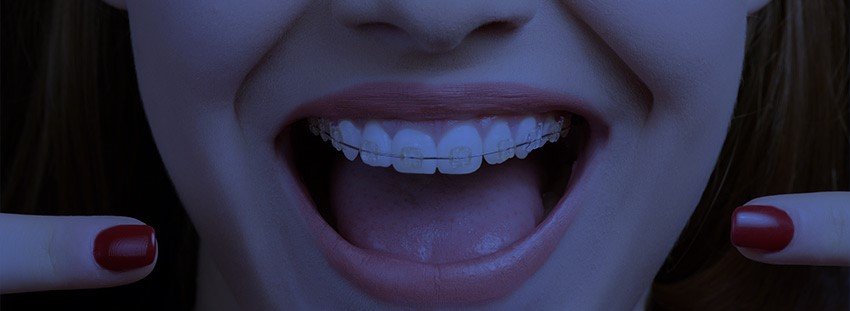 Aparelho Fixo e Móvel